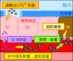 腸での炎症性疾患の発症イメージ